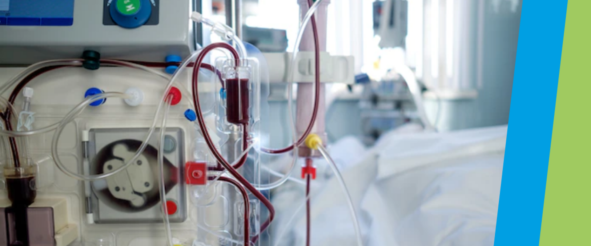 Nueva capacidad terapéutica: Hemodiálisis pediátrica en nuestro Hospital