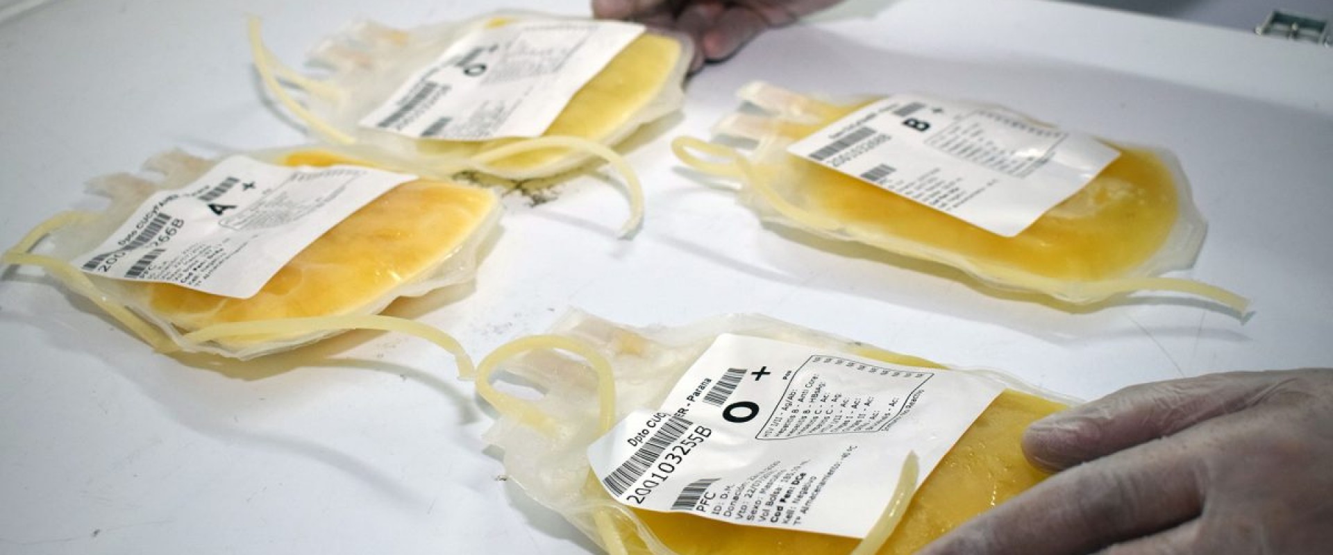 Uso de Plasma de Convalecientes Covid-19, por la Dra. Marina Alegre